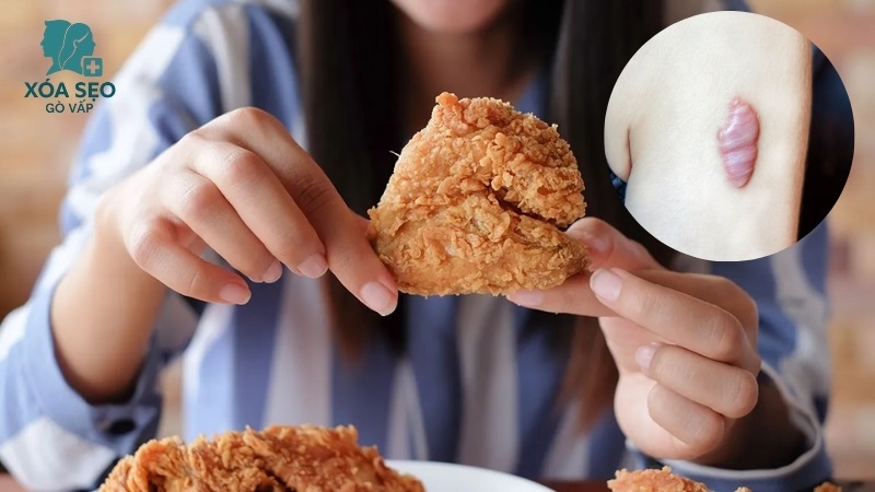 Ăn thịt gà có bị sẹo lồi không?
