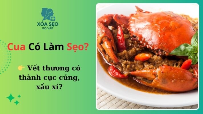 Ăn cua có bị sẹo lồi hay không