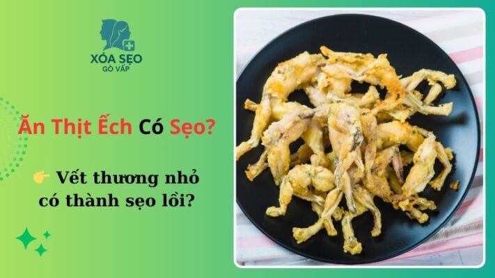 Ăn ếch có bị sẹo lồi không