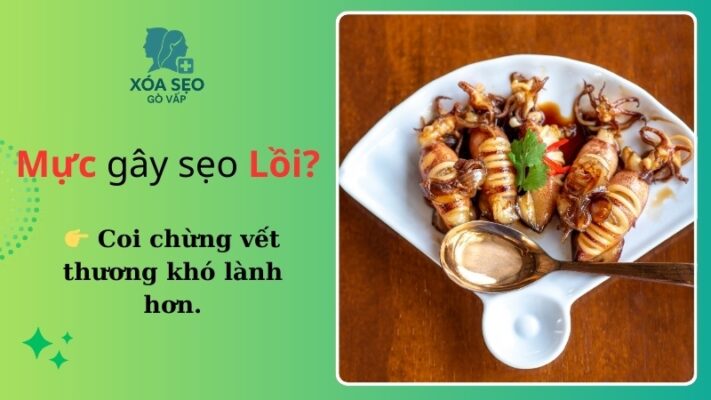 Ăn mực có bị sẹo lồi không