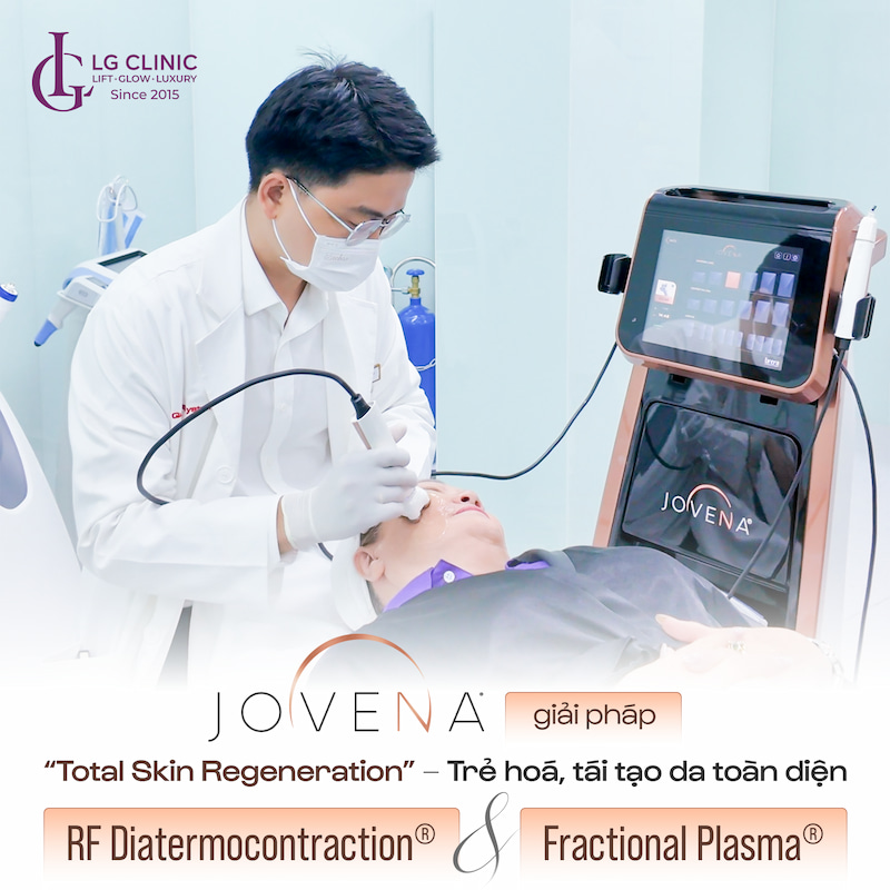 công nghệ jovena