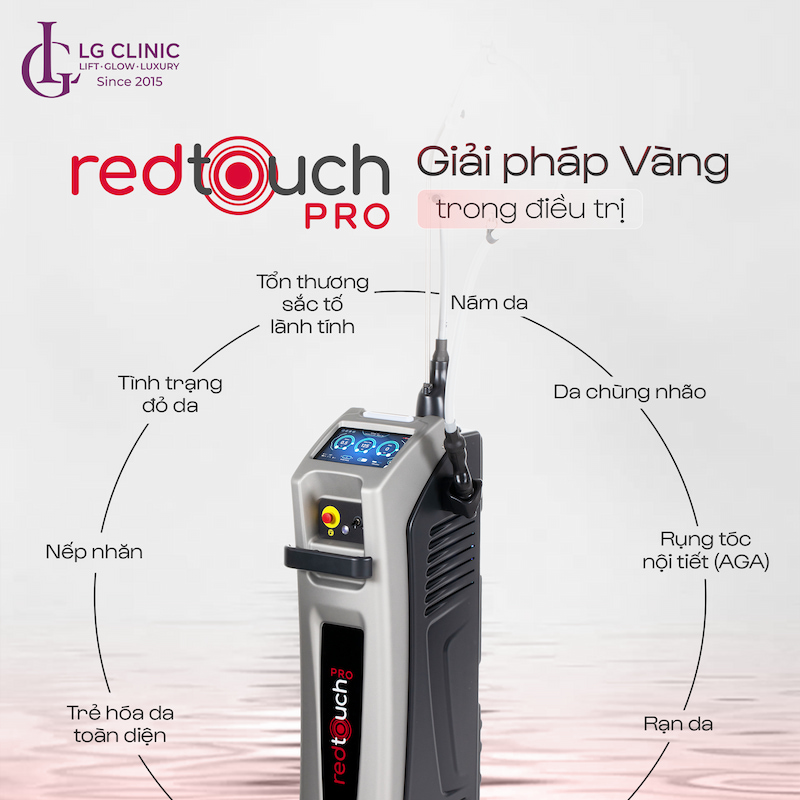 công nghệ redtouch pro